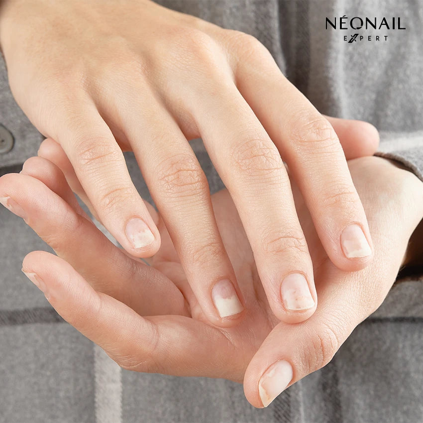 Ricostruzione unghie: quando non si può fare?